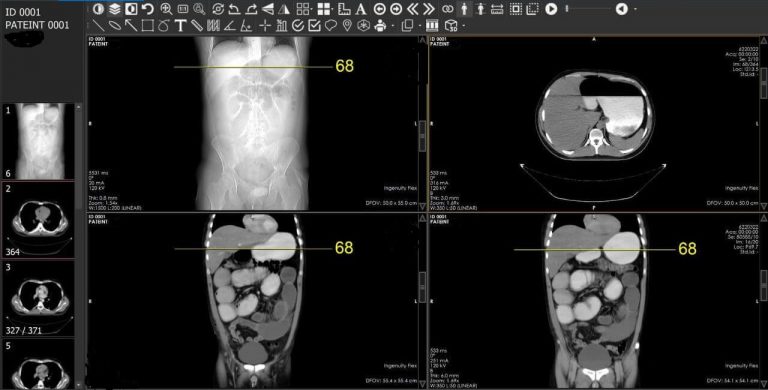 Scanner abdomen