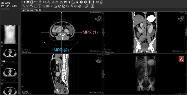 Scanner abdomen