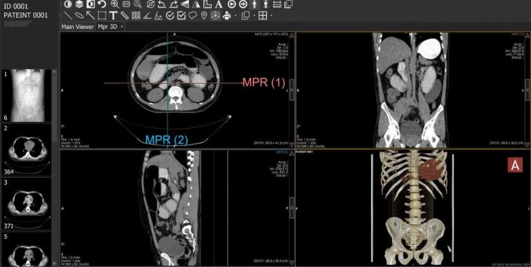 Scanner abdomen